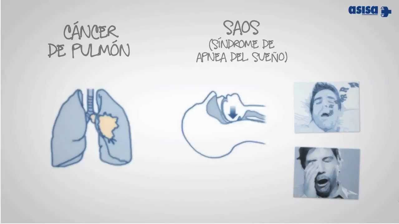Neumologia - i-Healthcare