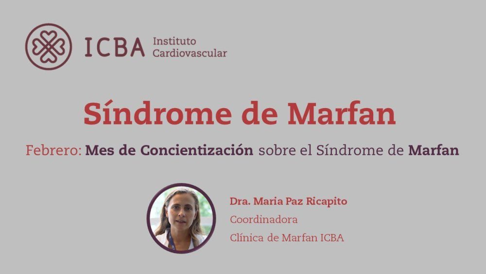 Sindrome-de-Marfan - i-Healthcare
