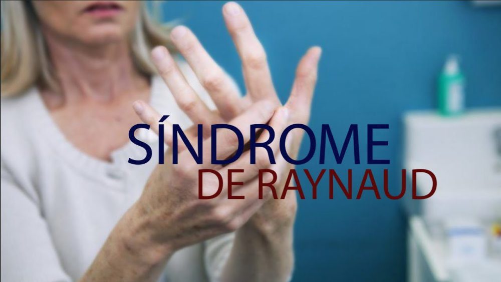 Sindrome-de-Raynaud - i-Healthcare