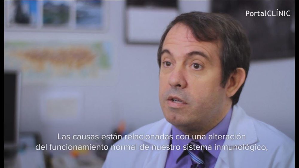 Sindrome-de-Sjogren - i-Healthcare