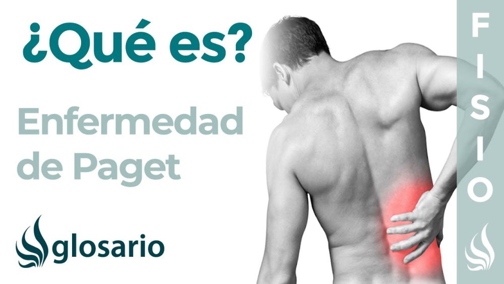 enfermedad-de-paget - i-Healthcare