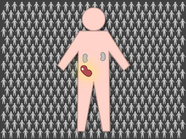 Belatacept - i-Healthcare