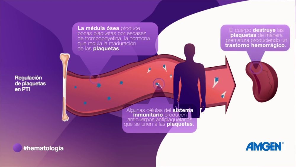 enfermedad-purpura - i-Healthcare