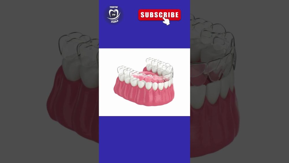 Dentista-en-Ayna - i-Healthcare