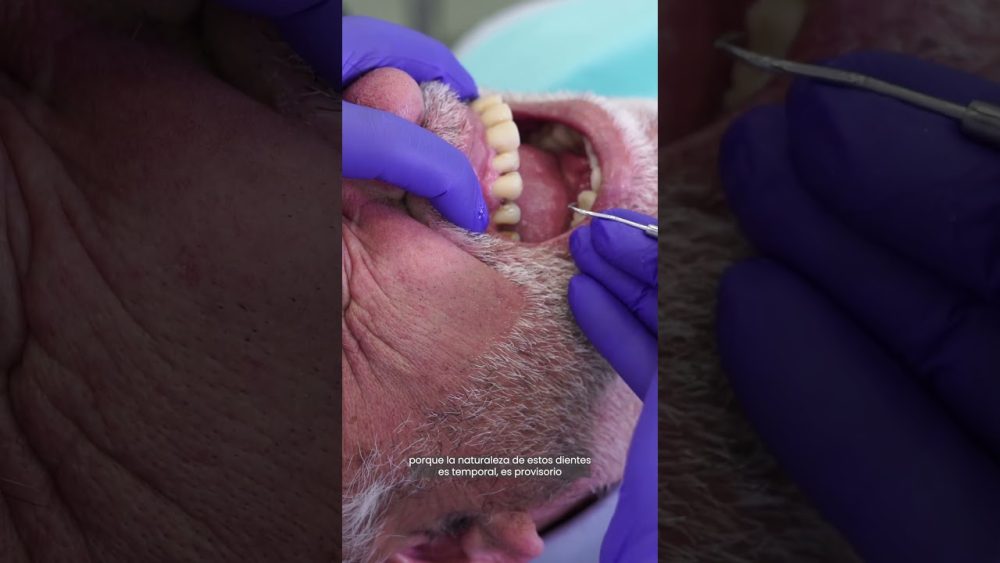 Dentista-en-Campezo - i-Healthcare