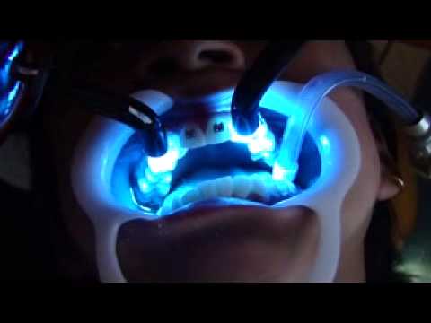 Dentista-en-Carcelen - i-Healthcare