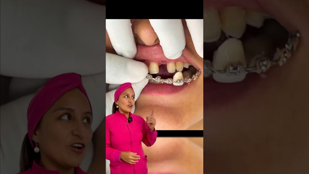 Dentista-en-Lantaron - i-Healthcare