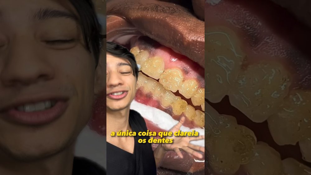 Dentista-en-Lietor - i-Healthcare
