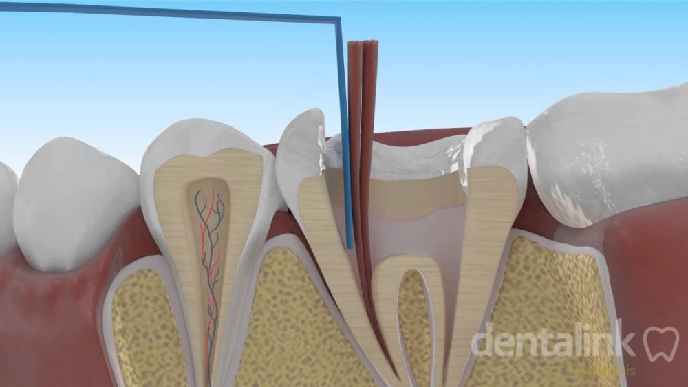 Dentista-en-Okondo - i-Healthcare