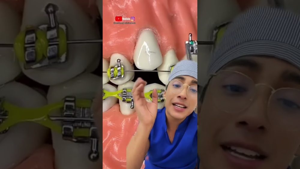 Dentista-en-Oyon-Oion - i-Healthcare