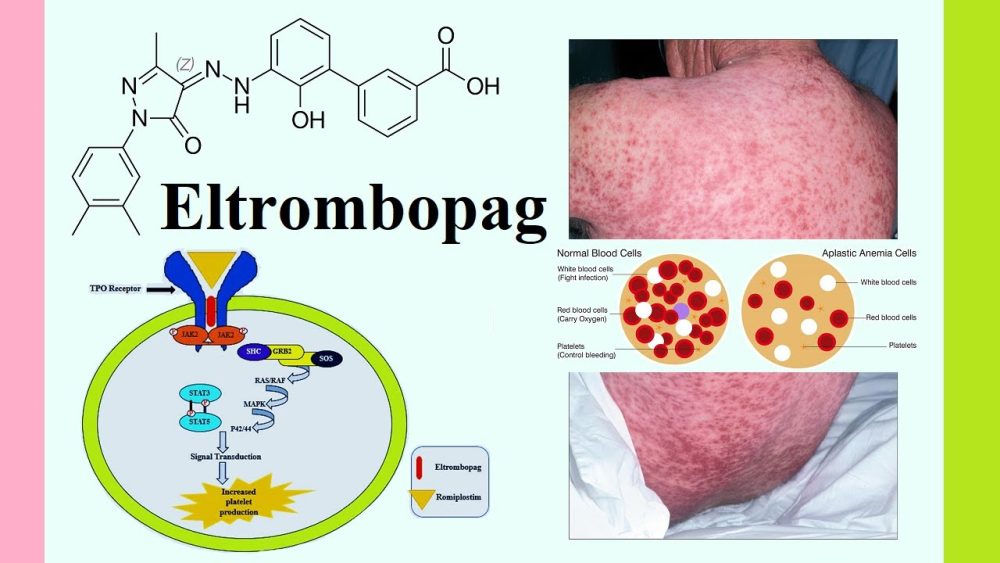 Eltrombopag - i-Healthcare