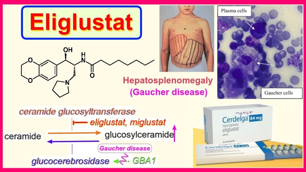 Miglustato - i-Healthcare