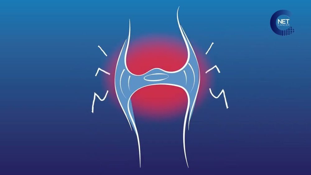 Vemurafenib - i-Healthcare