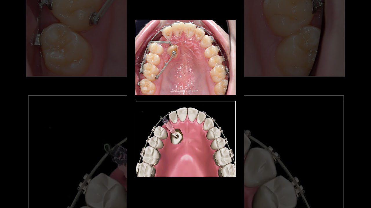 Dentista-en-Planes - i-Healthcare