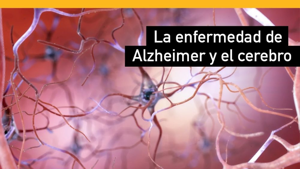 Enfoques-Integradores-en-el-Tratamiento-de-la-Enfermedad-de-Alzheimer - i-Healthcare