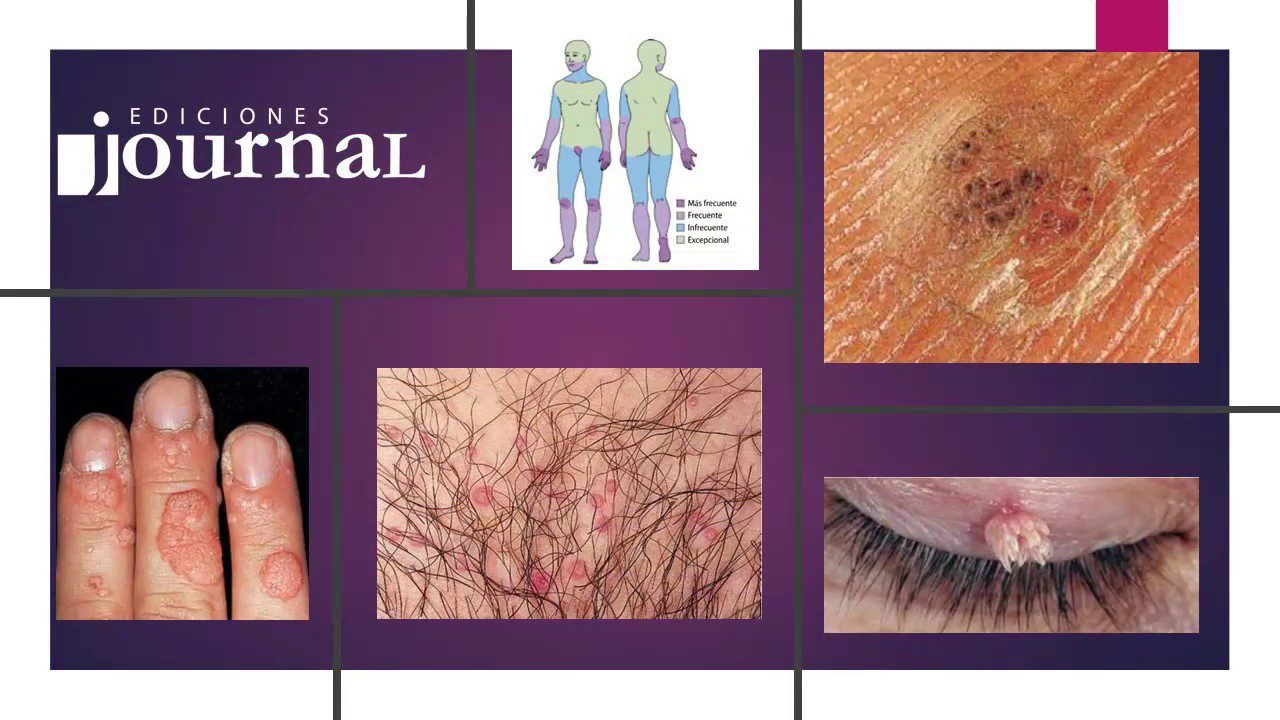 Telemedicina-Dermatologica-Diagnostico-y-Tratamiento-Remoto-de-Enfermedades-de-la-Piel - i-Healthcare