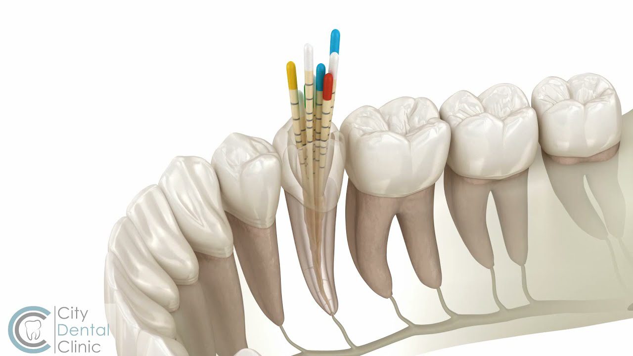 Dentista-en-Illar - i-Healthcare