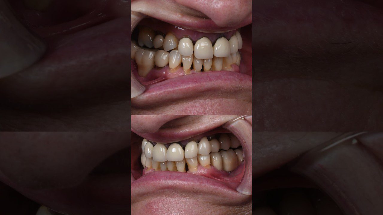 Dentista-en-Tahal - i-Healthcare