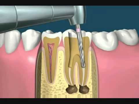 Dentista-en-Verger - i-Healthcare