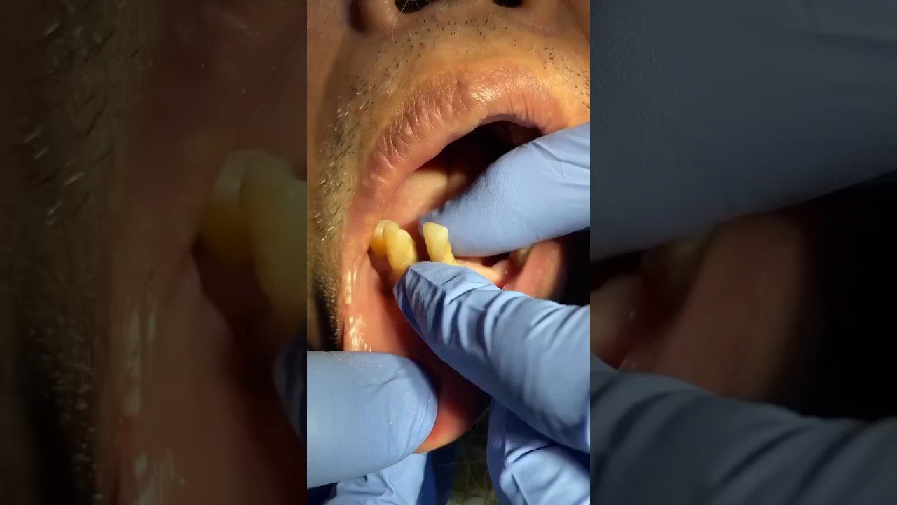 Dentista-en-Berrocalejo-de-Aragona - i-Healthcare