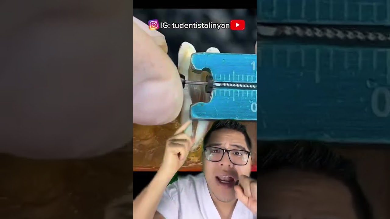 Dentista-en-Cabezas-de-Alambre - i-Healthcare