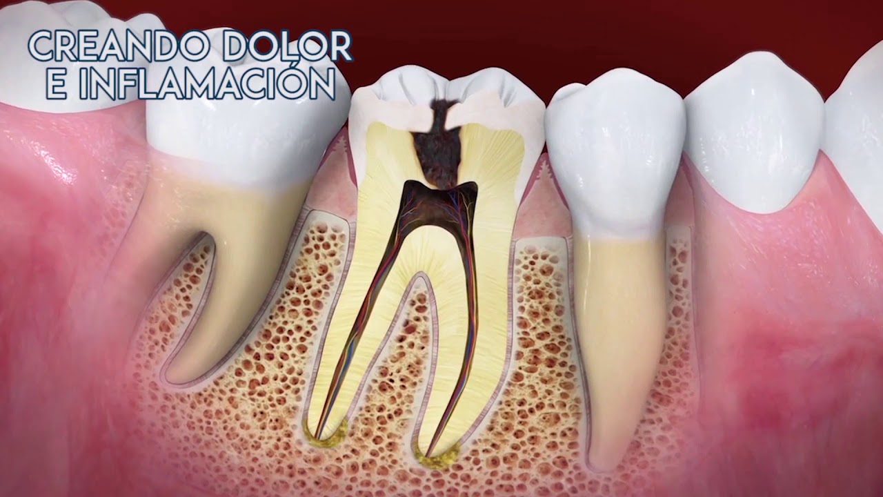 Dentista-en-Canales - i-Healthcare