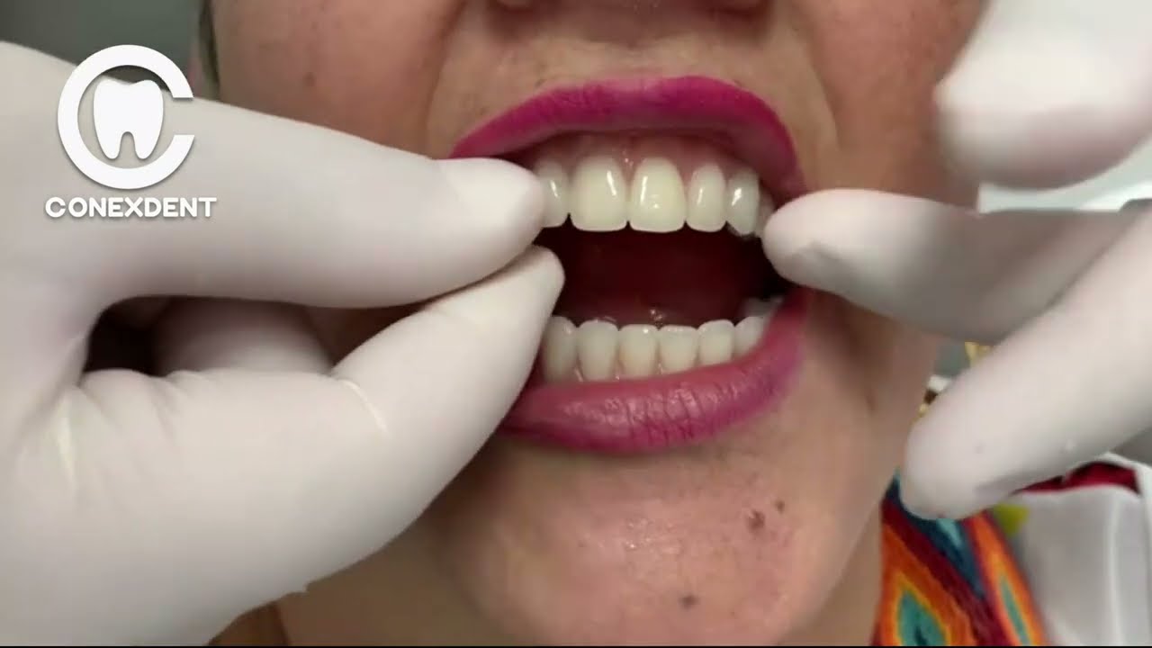 Dentista-en-Mancera-de-Arriba - i-Healthcare