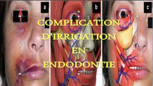 Fenilbutirato-De-Sodio - i-Healthcare
