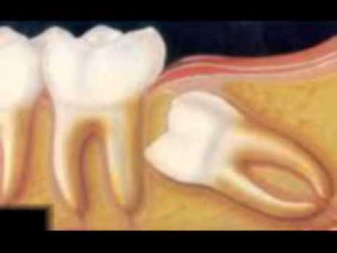 Centro-de-salud-de-Malgrat-de-Mar - i-Healthcare Centro de salud de Malgrat de Mar