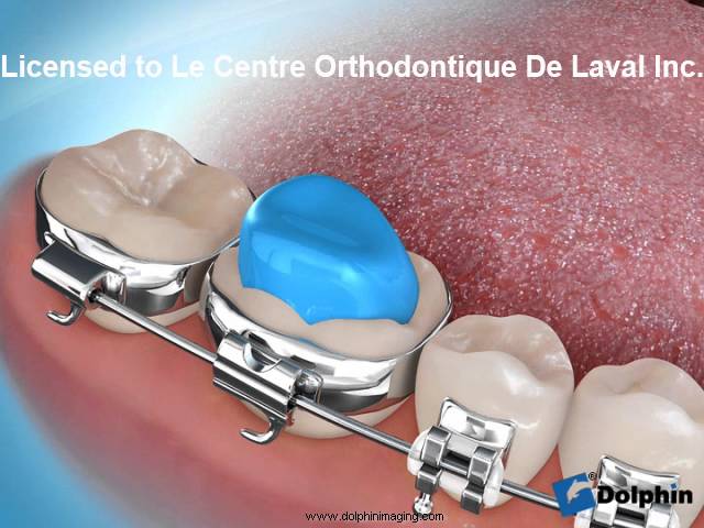 Dentista en  Calders
