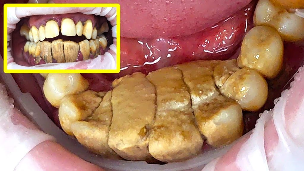 Dentista en  Callús