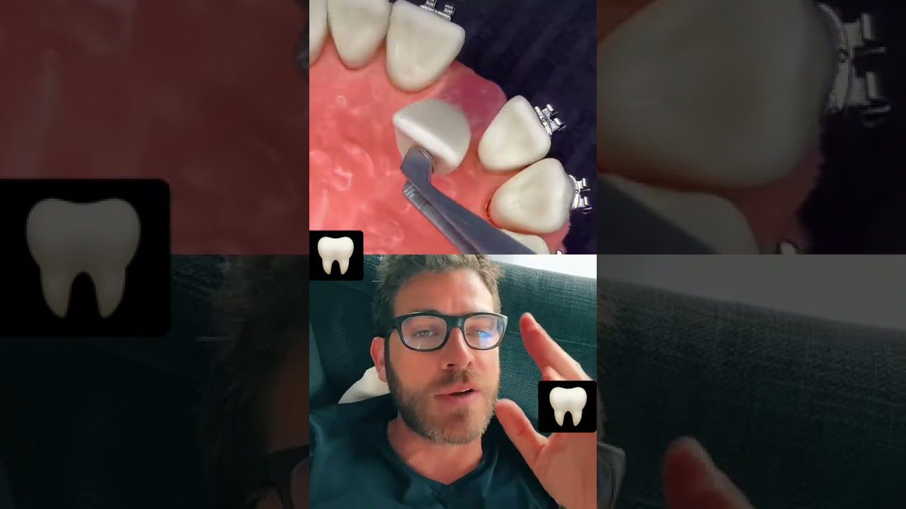 Dentista-en-Campins - i-Healthcare Dentista en Campins
