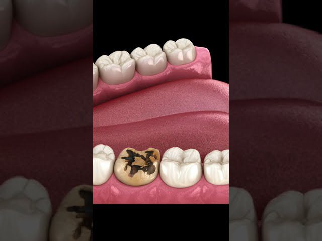 Dentista en  Canovelles