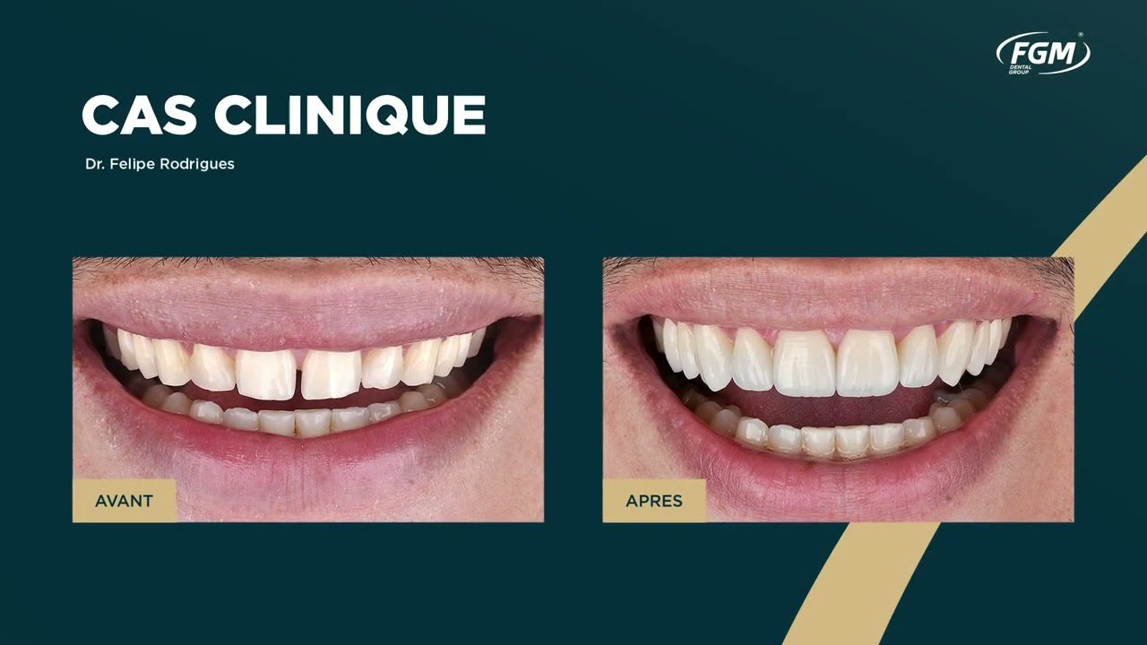Dentista-en-Canoves-i-Samalus - i-Healthcare Dentista en Cànoves i Samalús