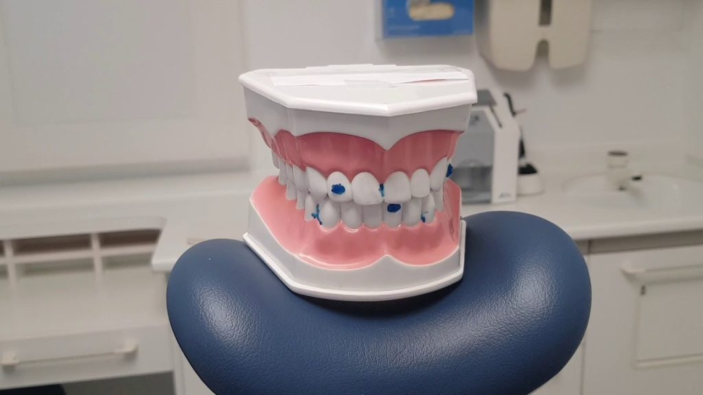 Dentista en  Carme