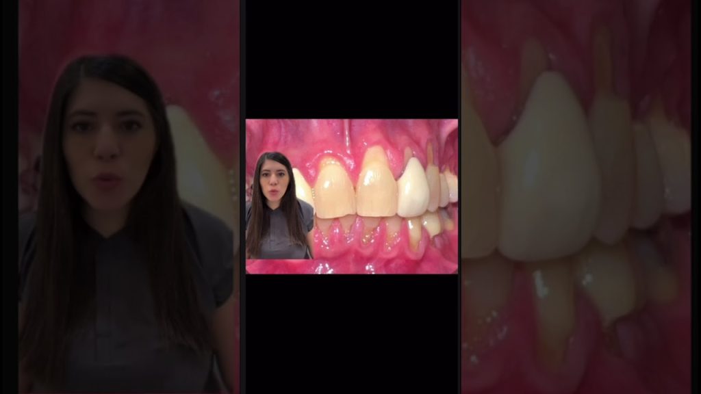 Dentista en  Castellbell i el Vilar