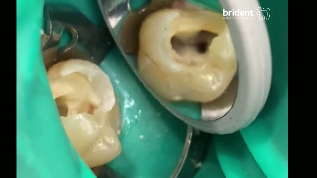 Dentista en  Castellfollit de Riubregós