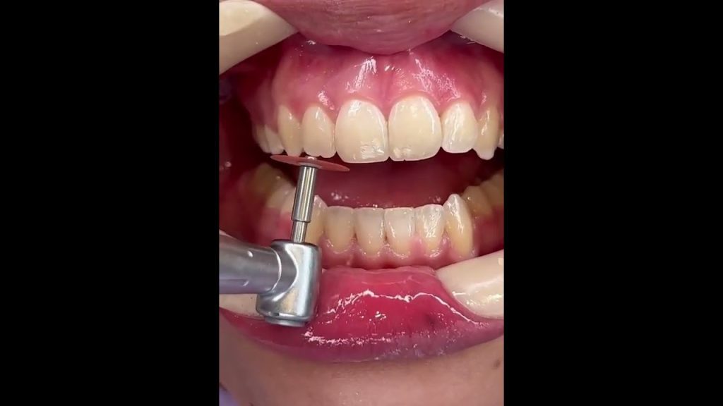 Dentista en  Centelles
