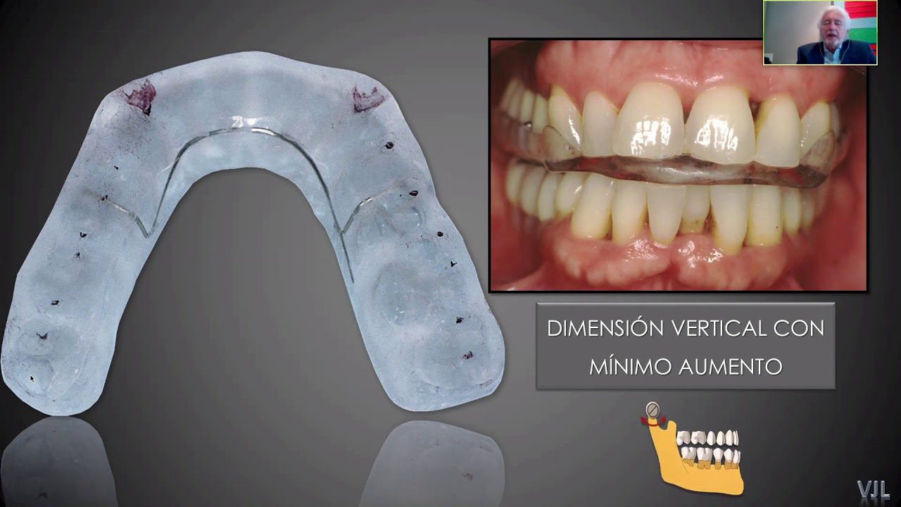Dentista-en-Figols - i-Healthcare Dentista en Fígols