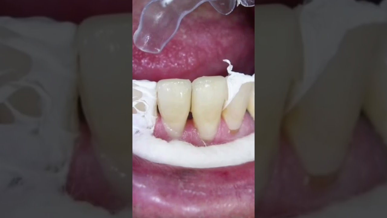 Dentista en  Font rubí