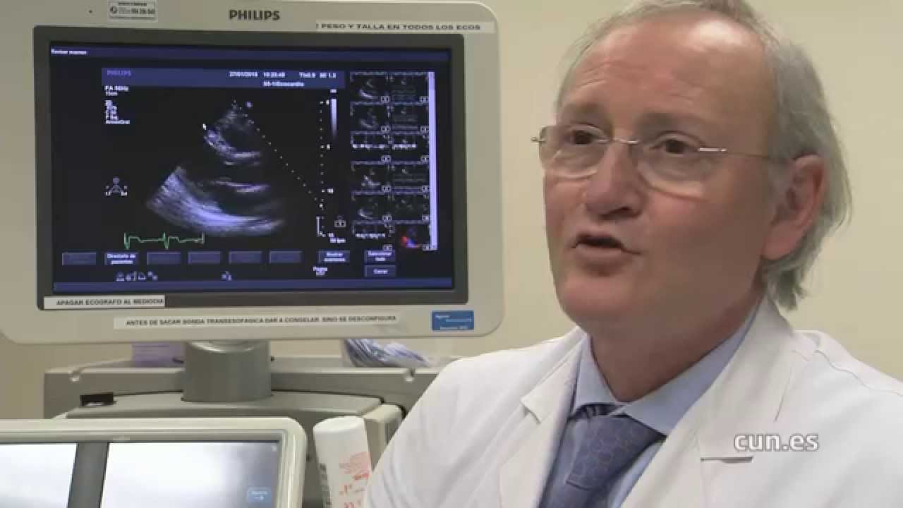 Los beneficios del ejercicio cardiovascular para la salud femenina