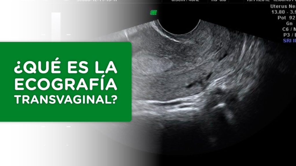 Todo lo que necesitas saber sobre la ecografía transvaginal