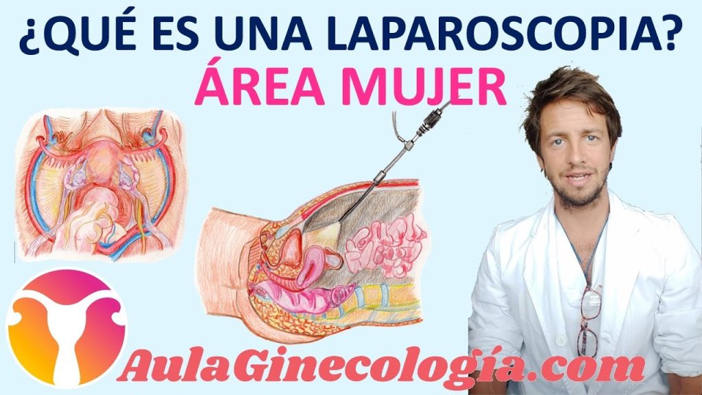 Todo lo que necesitas saber sobre la laparoscopia ginecológica