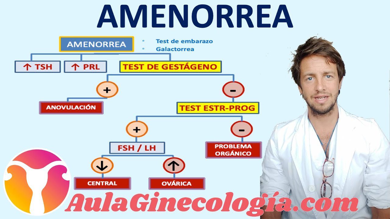 Como-manejar-la-amenorrea-secundaria - i-Healthcare Cómo manejar la amenorrea secundaria