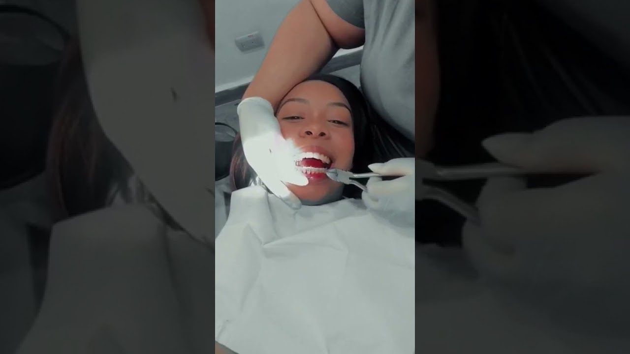 Dentista en  Montesquiu