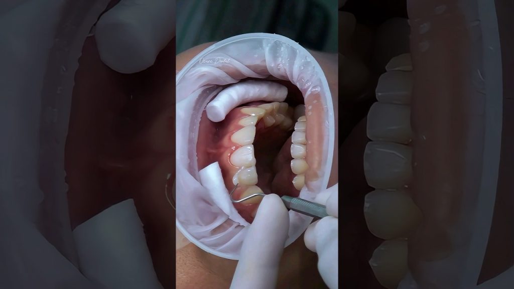Dentista en  Orpí