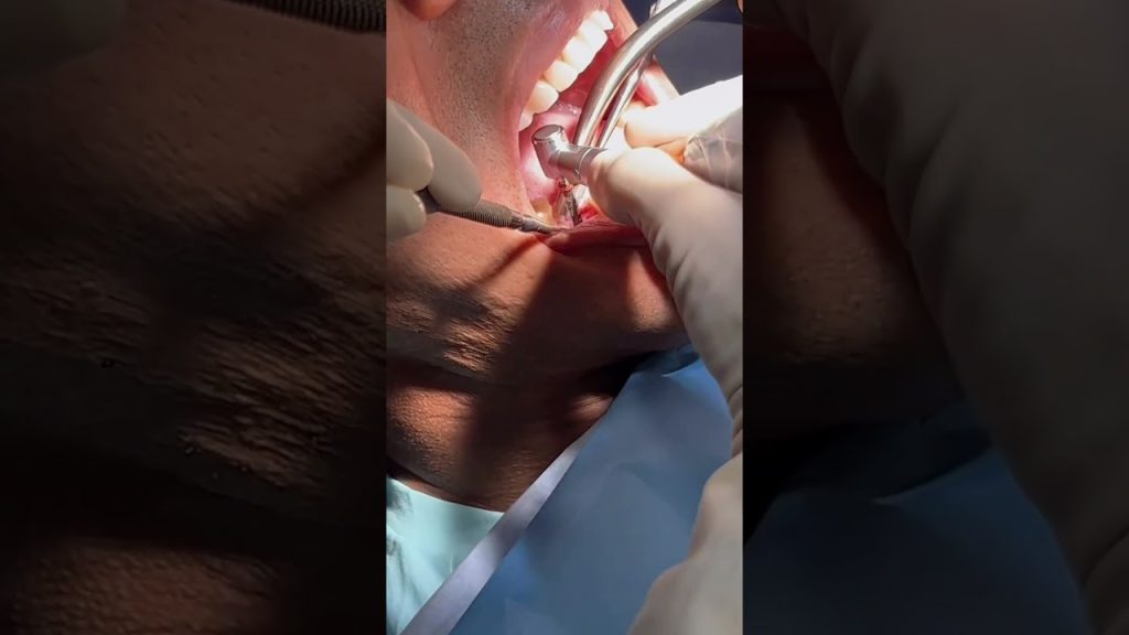 Dentista en  Puigdàlber