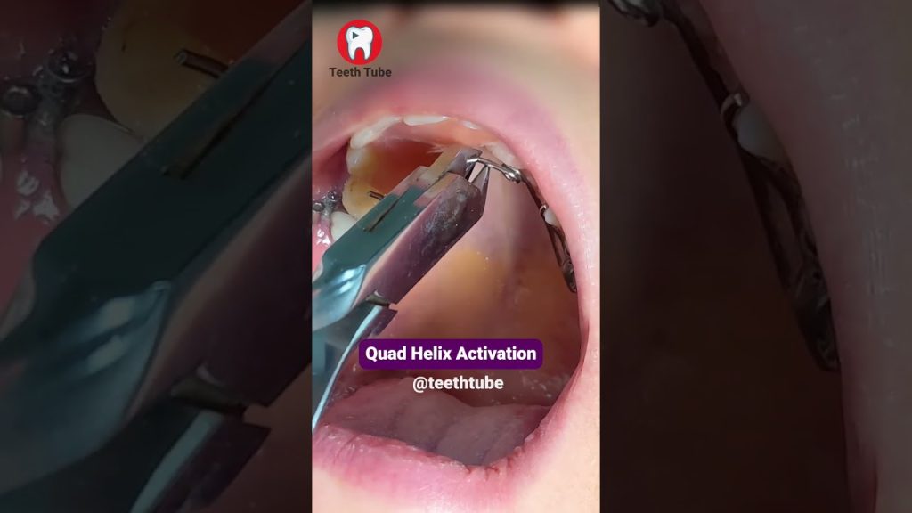 Dentista en  Quar