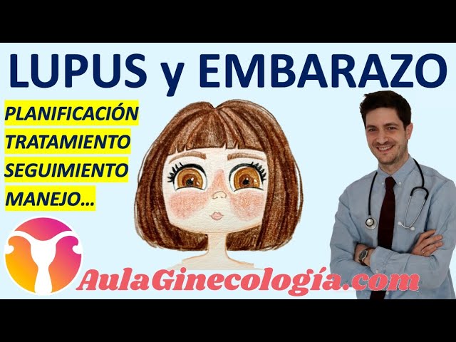 Todo sobre el seguimiento del embarazo con lupus