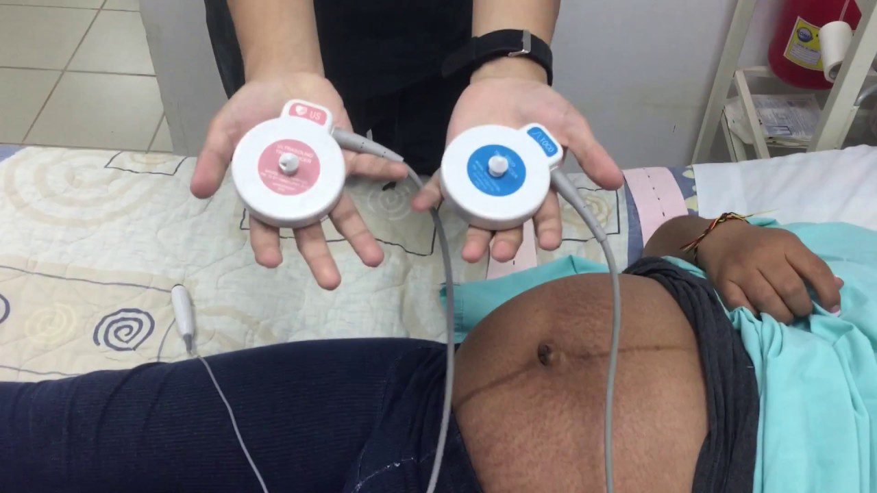 Todo-sobre-la-monitorizacion-del-embarazo-con-ecografias - i-Healthcare Todo sobre la monitorización del embarazo con ecografías